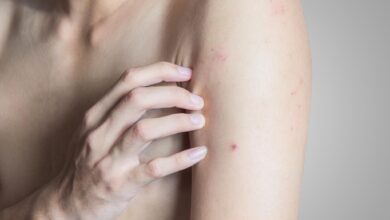 Rote Punkte auf der Haut