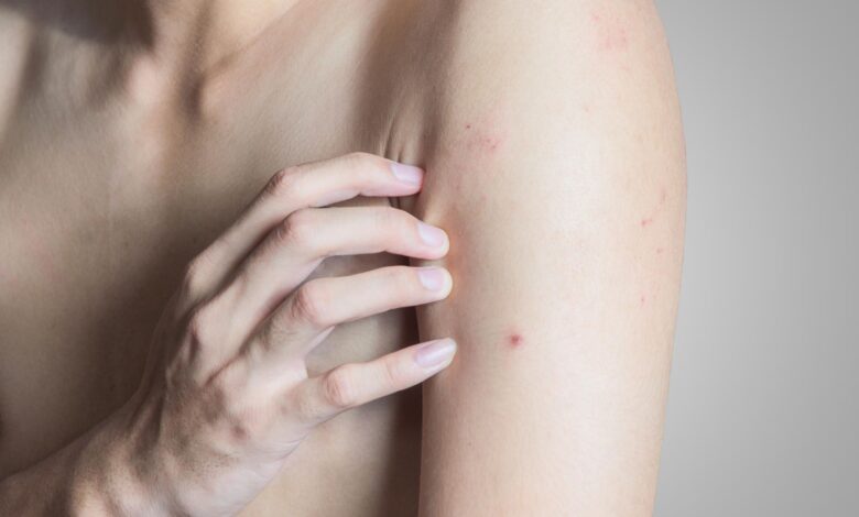 Rote Punkte auf der Haut